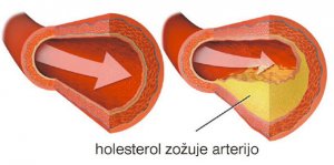 Holesterol in trigliceridi